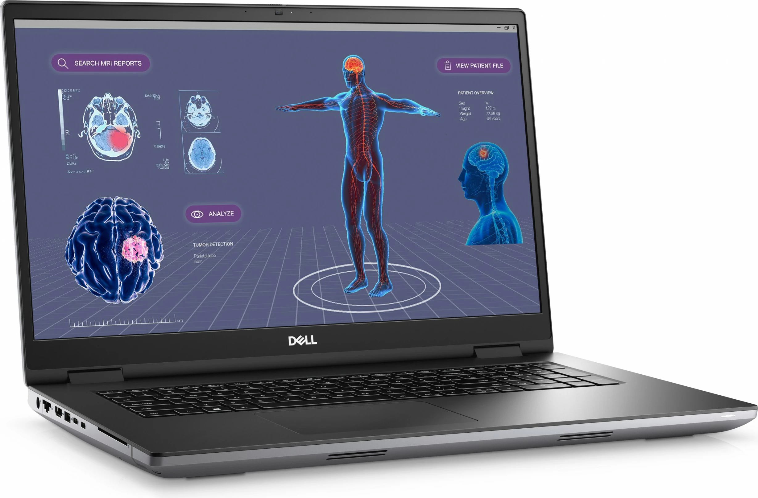 Laptop DELL Precision 7780, Intel Core i9, 32 GB RAM, 1 TB, 17.3", Gri