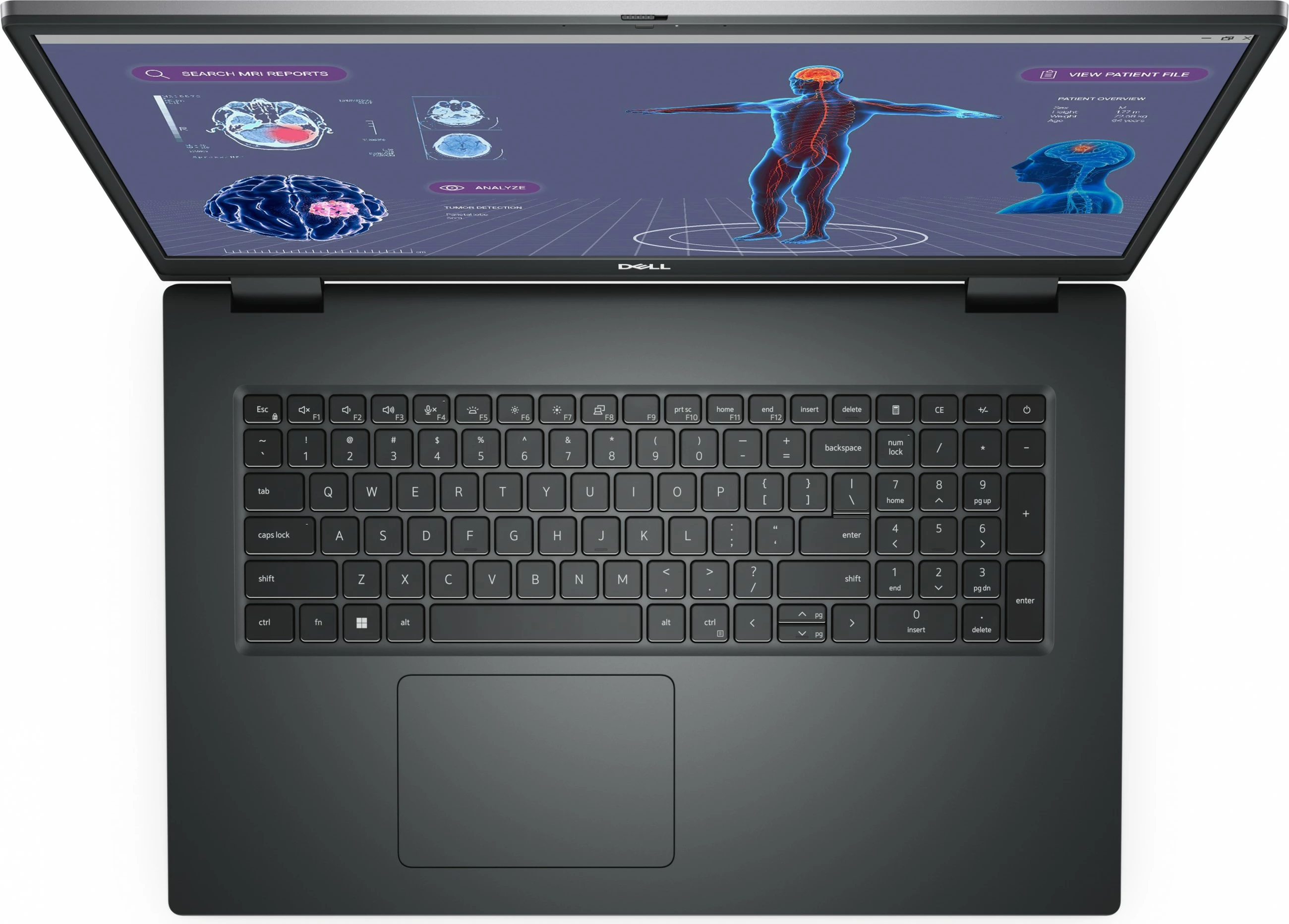 Laptop DELL Precision 7780, Intel Core i9, 32 GB RAM, 1 TB, 17.3", Gri